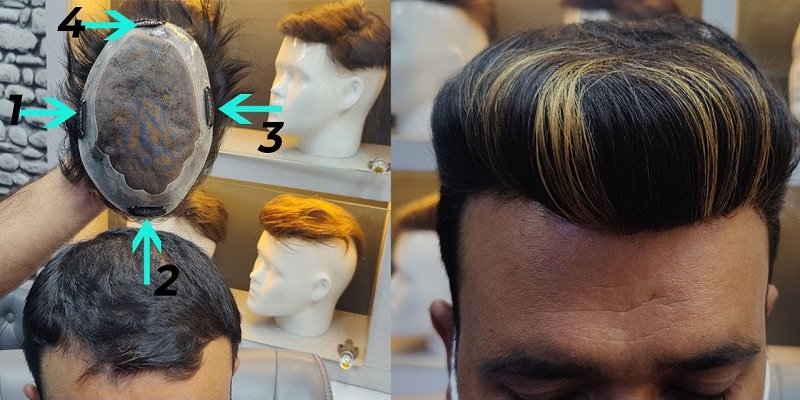 Clipping Hair Patch